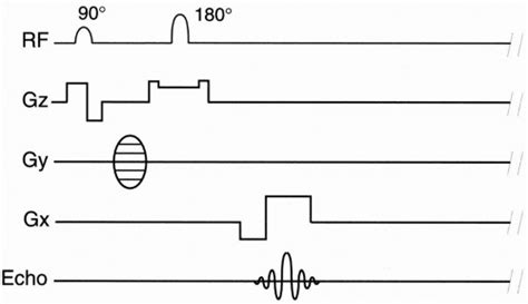 Pulse Sequence Diagram | Radiology Key