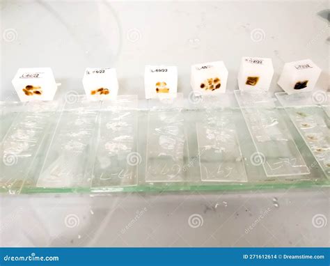 Histology Paraffin Embedded Tissue Samples Into A Slide Stock ...