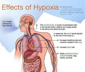 Cyanosis, Hypoxia types, causes, symptoms and Effectiveness of O2 ...