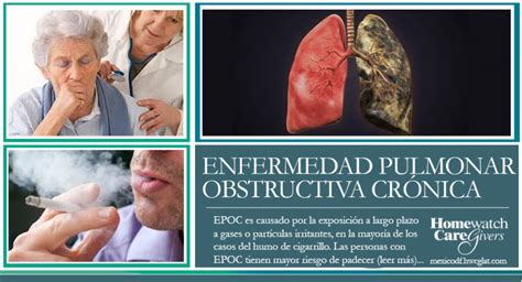 EPOC Enfermedad Pulmonar Obstructiva Crónica