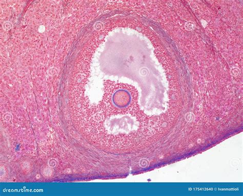 Follicle and Egg Cell in Human Ovary Under Microscope Stock Photo - Image of sample, research ...