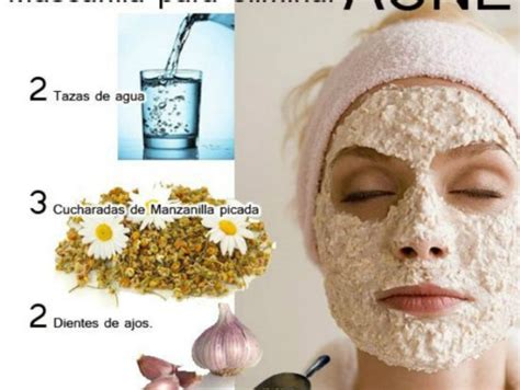 Klassifizieren Wachstum Feder mascarillas caseras para el acne ...