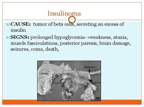 DISEASES OF THE PANCREAS INSULIN SHOCK Insulin Shock