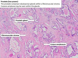 Prostate – Normal Histology – NUS Pathweb :: NUS Pathweb