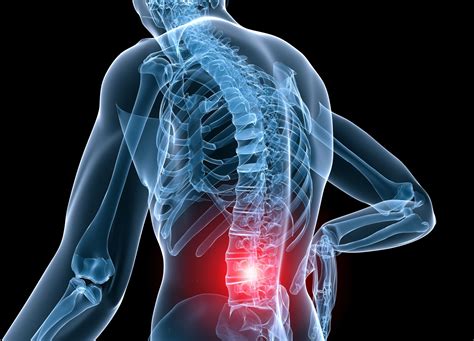 A Comprehensive Guide to the New Science of Treating Lower Back Pain - Optimal Fitness