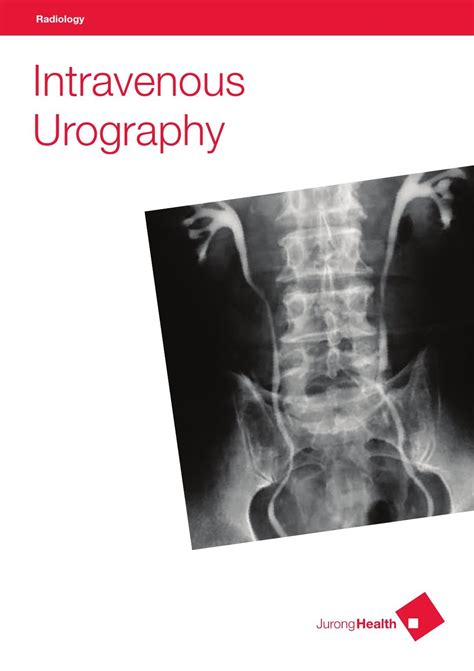 Radiology - Intravenous Urography by JurongHealth Campus - Issuu