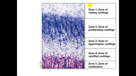 Bone Growth and Remodeling: Appositional and Interstitial Growth - YouTube