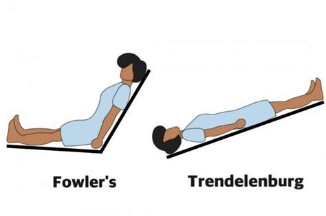 Stretcher: the Fowler's position, semi-Fowler, high Fowler, low Fowler