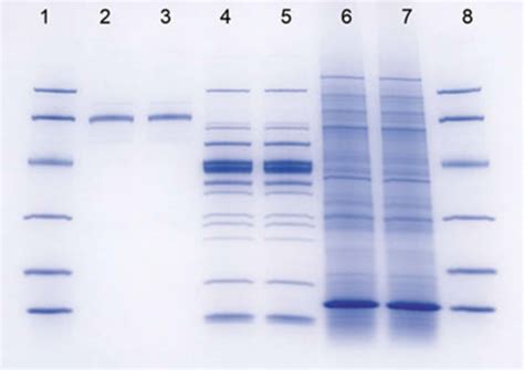 Electrophoresis Results