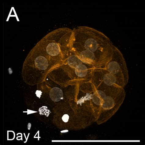 Morula Development - Embryology