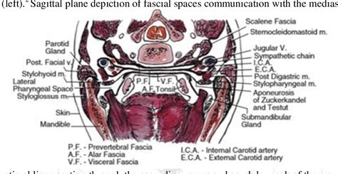 Figure 1 from Life-Threatening Complications of Odontogenic Infection (Literature Review ...