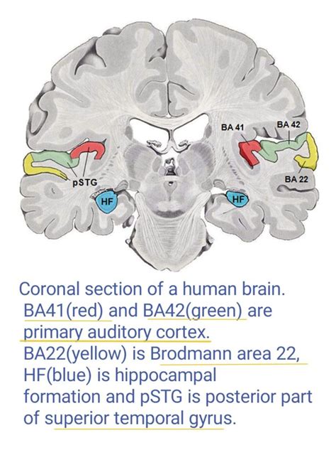 Primary Auditory Cortex