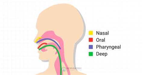 Airway Suctioning: Overview and Practice Questions (2023)