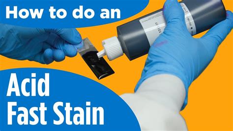 How to do an Acid-Fast Stain - Instructions for the lab/procedure - YouTube