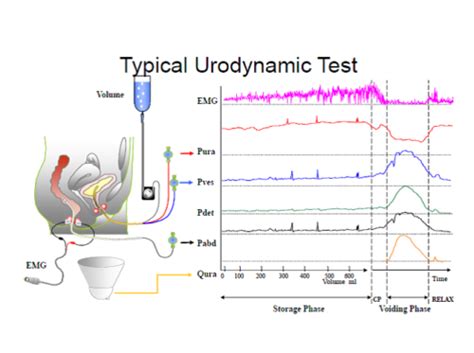 Urodynamics / Urodynamic Study - Urology Malaysia