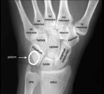 Case 21 – Checkhamate | Sport Med School