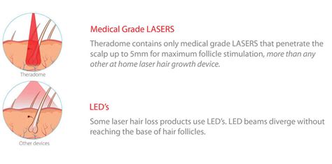 Laser vs LED for Hair Growth Treatments | Theradome