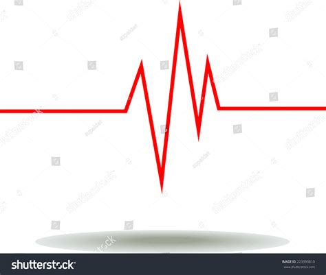 Electrocardiogram Ecg Graph Pulse Tracing Stock Vector (Royalty Free ...