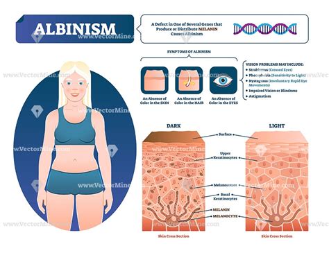 Pin on Health and medicine illustrated