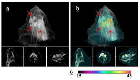 Image-guided NIR Spectroscopy – Optics in Medicine at Dartmouth