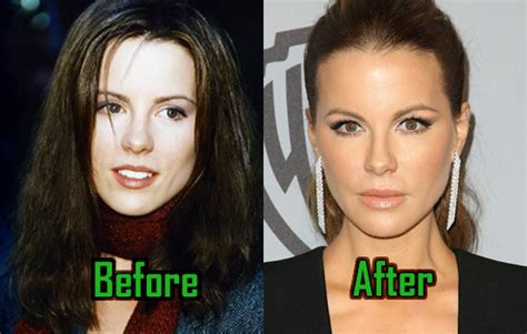 Kate Beckinsale Plastic Surgery: Nose Job, Botox, Before & after ...