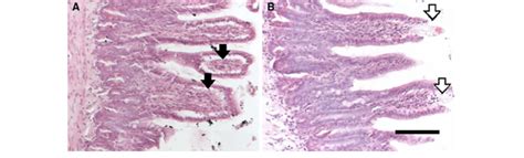 Histology of representative tissue specimens of the terminal ileum... | Download Scientific Diagram