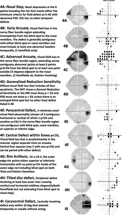 Visual field defect classification in the Zhongshan Ophthalmic Center–Brien Holden Vision ...