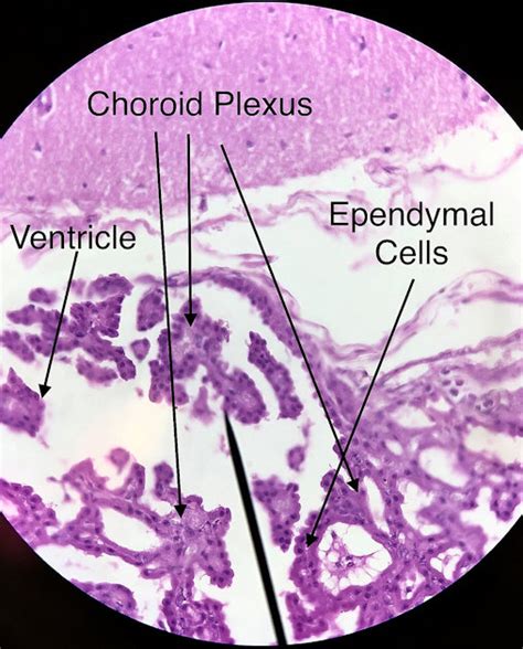 Ependymal cell and the choroid plexus histology