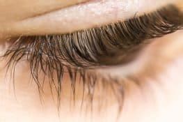 Eyelash Mites Causes and Prevention