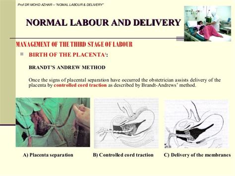 Normal labour and delivery