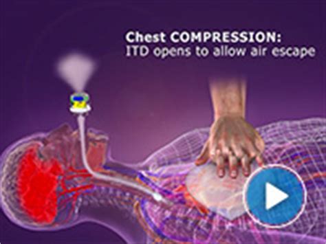 ResQPOD - Impedance Threshold Device (ITD) - CPR - ZOLL