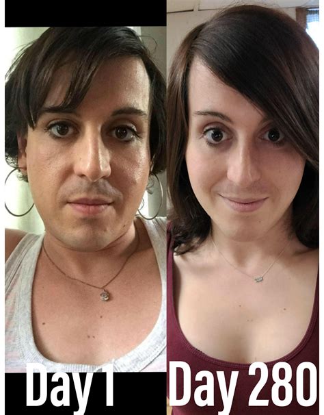 Day 1 vs 9 months hrt. No makeup / filter. Some days are a struggle, but beginning to appreciate ...