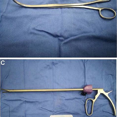 A novel simple intra-corporeal Pringle maneuver for laparoscopic hemihepatectomy: how we do it ...