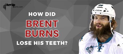 How Did Brent Burns Lose His Teeth? | | RevUp Sports