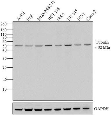 Overview of Western Blotting | Thermo Fisher Scientific - US