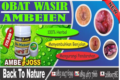 Pengertian Wasir | OBAT WASIR DI APOTIK DE NATURE