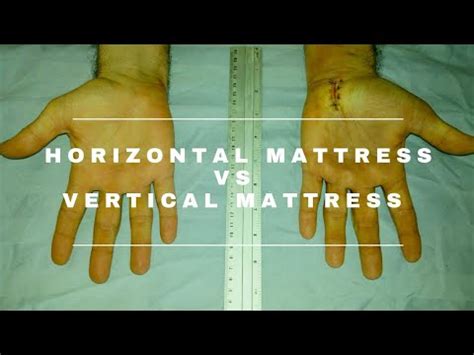 How to suture: Horizontal mattress vs Vertical mattress - YouTube