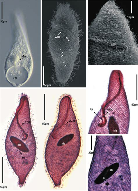 Morphology of Spirostomum teres (9) image obtained with differential ...