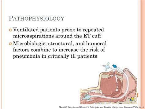 Ventilator Associated Pneumonia (VAP) or Hospital Acquired Pneumonia