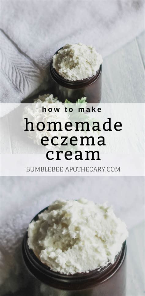 Homemade Eczema Cream | Eczema cream, Eczema cream recipe, Natural medicine recipes