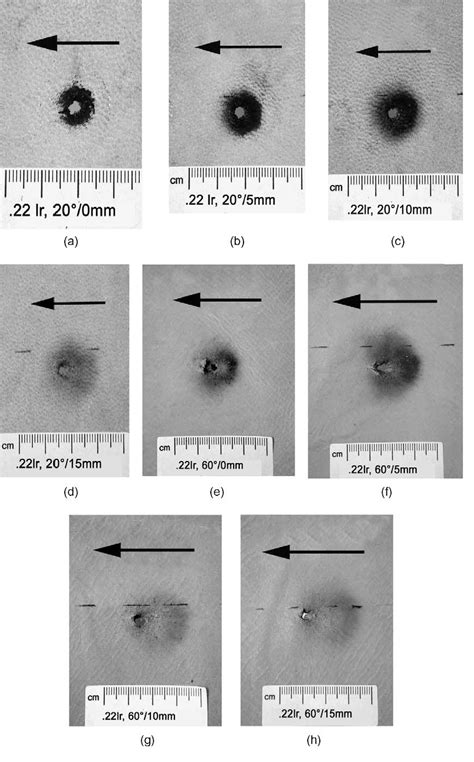 Figure 5 from Gunshot residue patterns on skin in angled contact and near contact gunshot wounds ...