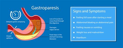 Ozempic Lawsuit for Gastroparesis | Saiontz & Kirk, P.A.