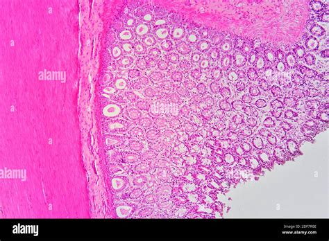 Human vermiform appendix cross section showing (left to right ...