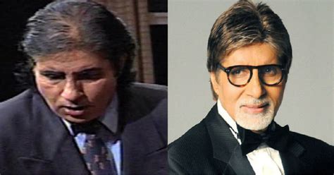 From Bollywood to Hollywood - Celebrities Who Went for Hair Transplant