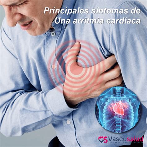 Principales síntomas de una arritmia cardíaca - Vascusalud