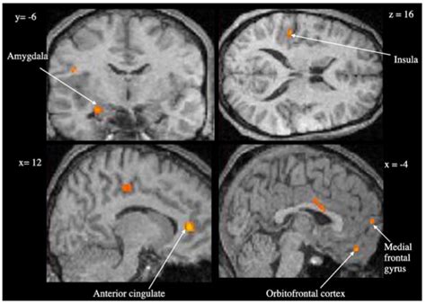 The Neural Correlates of Emotional Memory Retrieval | Emotion, Brain ...