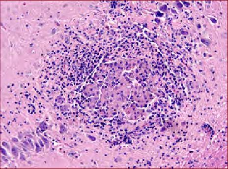 Rabbit. Encephalitozoon cuniculi: parassitic granuloma in the... | Download Scientific Diagram