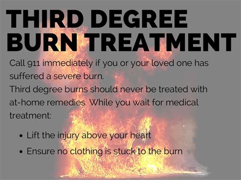 Burn Injury: Burn Types, Treatments, and Causes