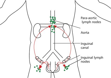 Lymph Nodes In The Groin Region