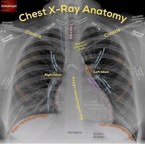 Pin by Donna Baker on ANATOMY | Radiology, Medical anatomy, Anatomy